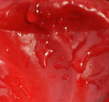 filler image